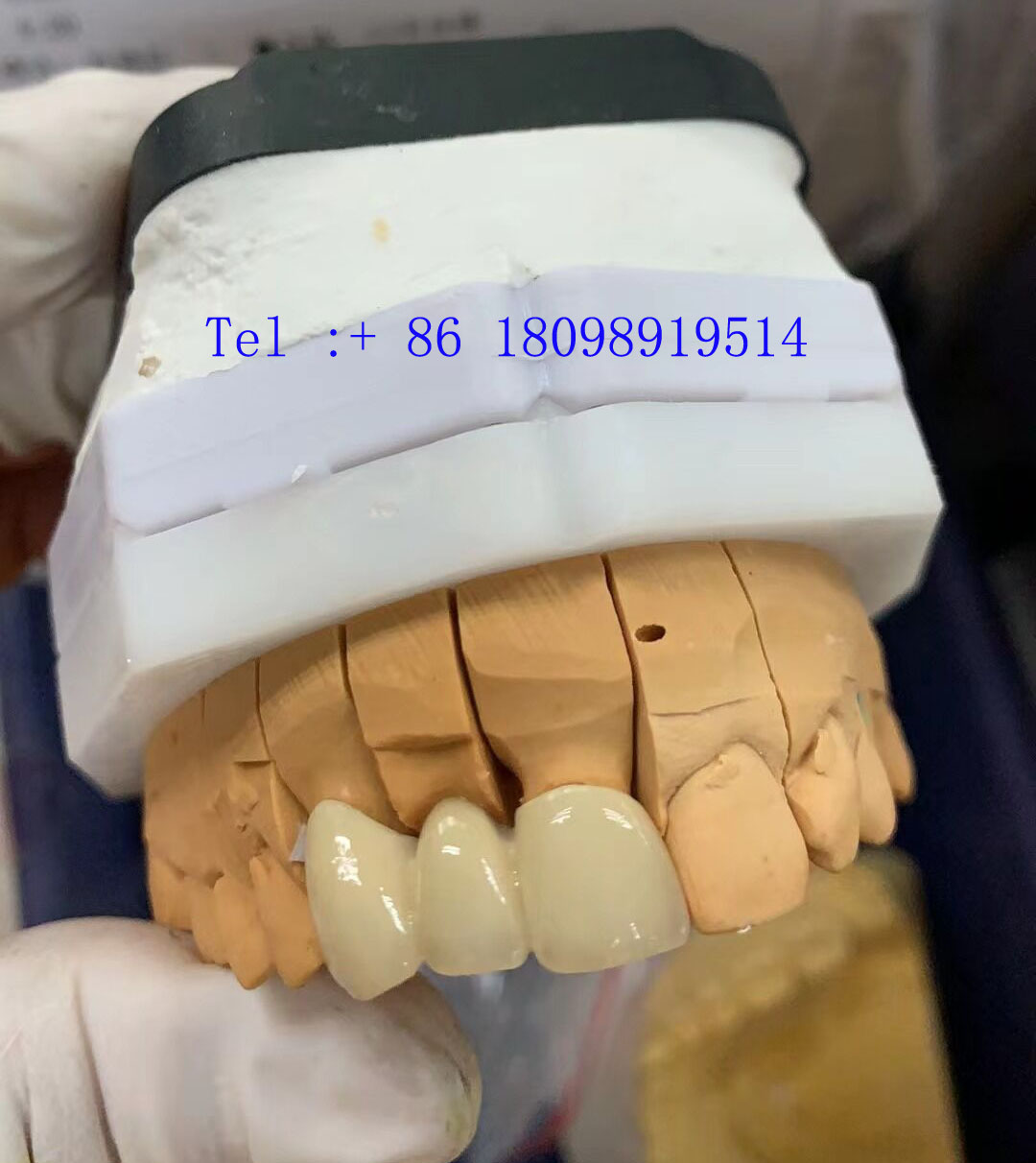深圳国际假牙出口工厂义齿厂家外贸 - 墨华网